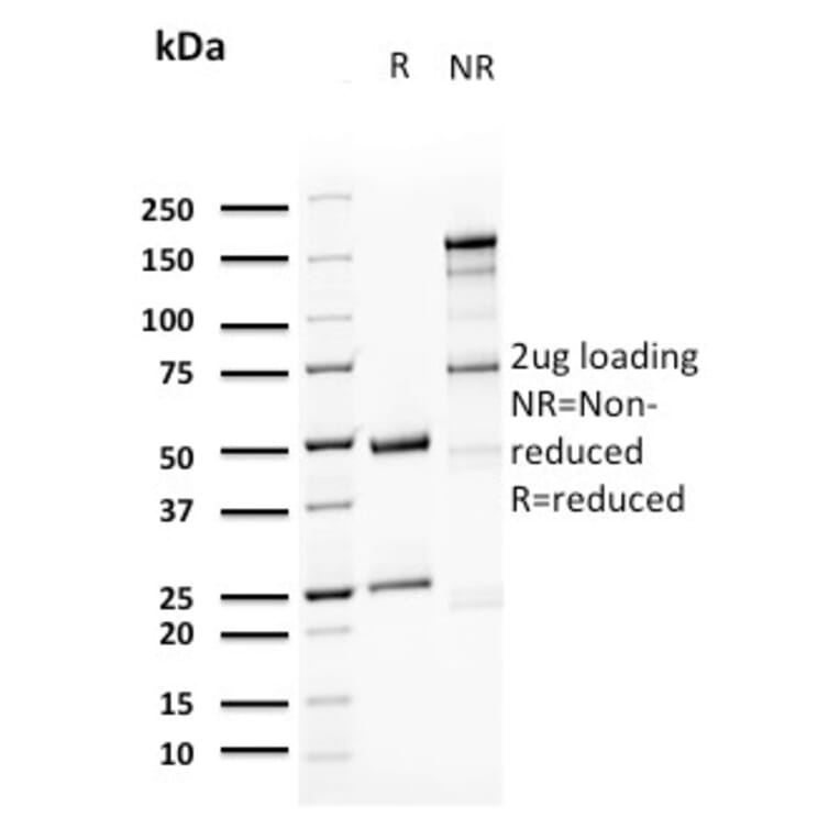 SDS-PAGE - Anti-Uroplakin 1A Antibody [UPK1A/2923] - BSA and Azide free (A251367) - Antibodies.com