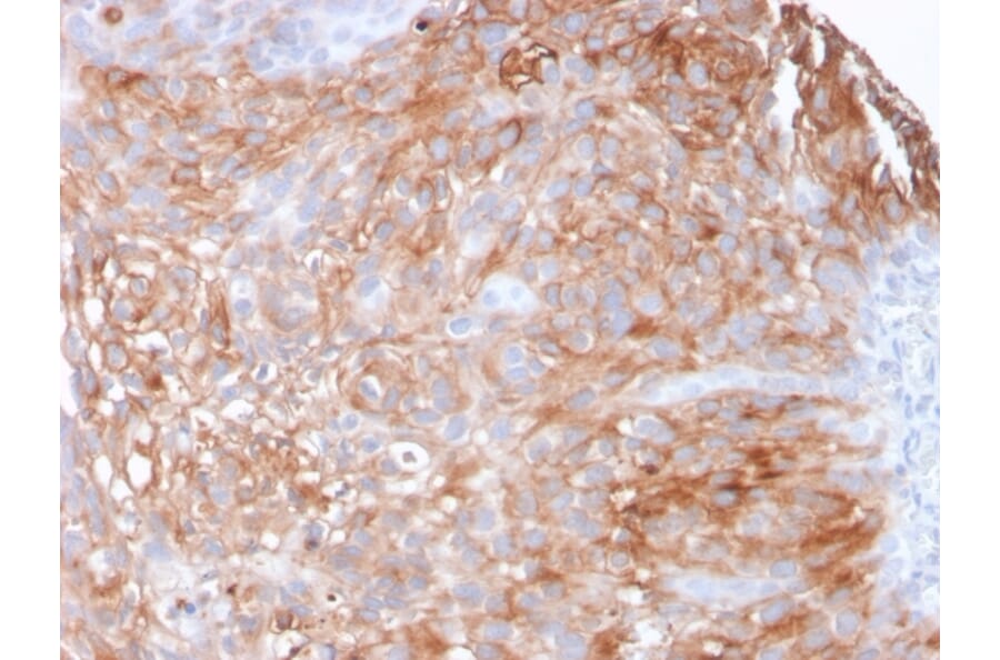Immunohistochemistry - Anti-Uroplakin 1A Antibody [UPK1A/2925] - BSA and Azide free (A251369) - Antibodies.com