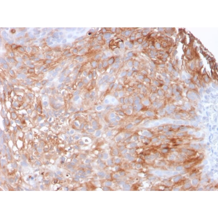 Immunohistochemistry - Anti-Uroplakin 1A Antibody [UPK1A/2925] - BSA and Azide free (A251369) - Antibodies.com