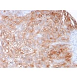 Immunohistochemistry - Anti-Uroplakin 1A Antibody [UPK1A/2925] - BSA and Azide free (A251369) - Antibodies.com