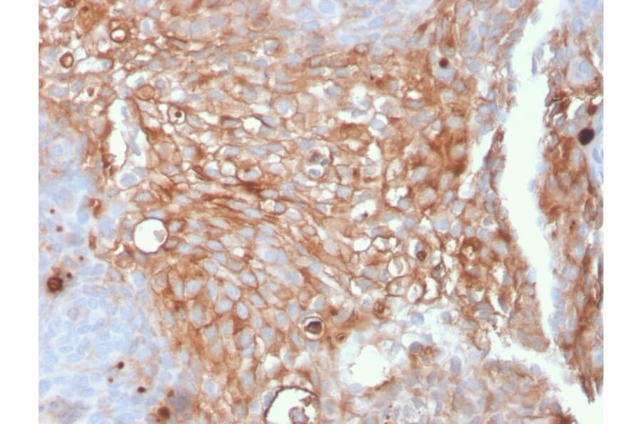 Immunohistochemistry - Anti-Uroplakin 1A Antibody [UPK1A/2925] - BSA and Azide free (A251369) - Antibodies.com