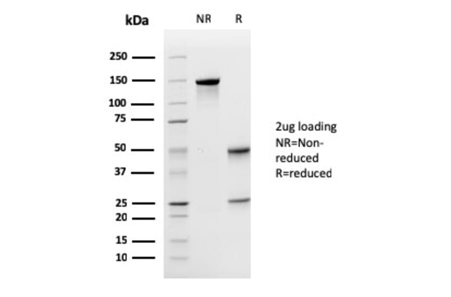 SDS-PAGE - Anti-Uroplakin 1A Antibody [UPK1A/2925] - BSA and Azide free (A251369) - Antibodies.com