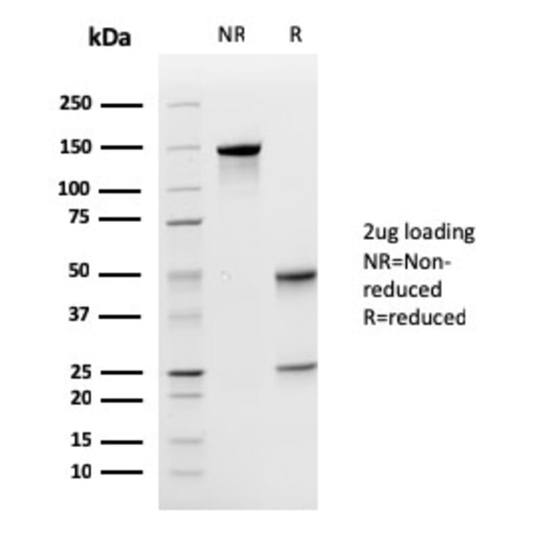 SDS-PAGE - Anti-Uroplakin 1A Antibody [UPK1A/2925] - BSA and Azide free (A251369) - Antibodies.com