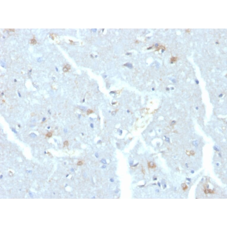 Immunohistochemistry - Anti-UBE2C Antibody [CPTC-UBE2C-1] - BSA and Azide free (A251369) - Antibodies.com