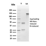 SDS-PAGE - Anti-UBE2C Antibody [CPTC-UBE2C-1] - BSA and Azide free (A251370) - Antibodies.com