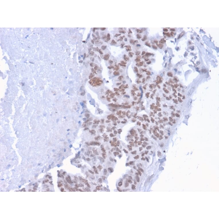 Immunohistochemistry - Anti-CHD4 Antibody [3F2/4] - BSA and Azide free (A251371) - Antibodies.com