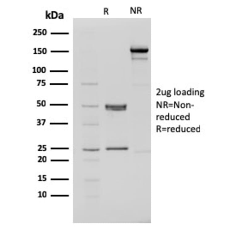 SDS-PAGE - Anti-CHD4 Antibody [3F2/4] - BSA and Azide free (A251371) - Antibodies.com