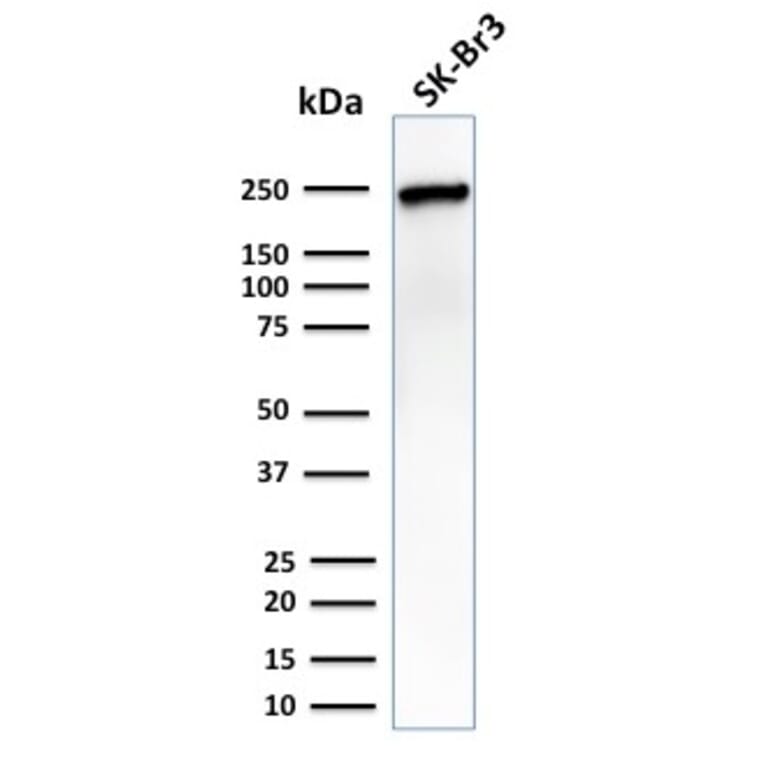 Western Blot - Anti-CHD4 Antibody [3F2/4] - BSA and Azide free (A251371) - Antibodies.com