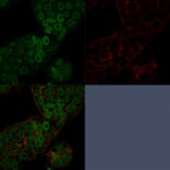 Immunofluorescence - Anti-CHD4 Antibody [3F2/4] - BSA and Azide free (A251370) - Antibodies.com