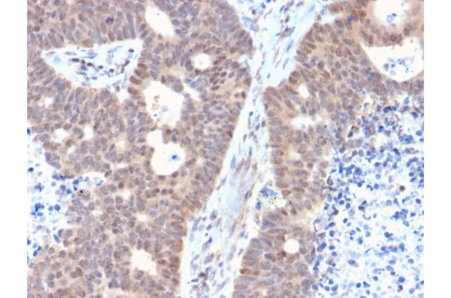 Immunohistochemistry - Anti-FAF1 Antibody [CPTC-FAF1-2] - BSA and Azide free (A251372) - Antibodies.com