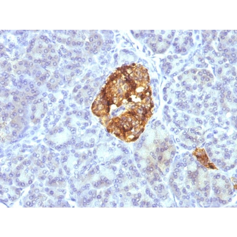 Immunohistochemistry - Anti-Chromogranin A Antibody [CGA/413 + CHGA/777 + CHGA/798] - BSA and Azide free (A251373) - Antibodies.com