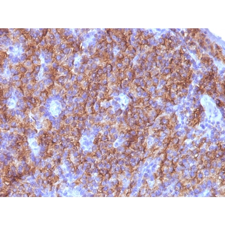 Immunohistochemistry - Anti-Chromogranin A Antibody [CGA/413 + CHGA/777 + CHGA/798] - BSA and Azide free (A251373) - Antibodies.com