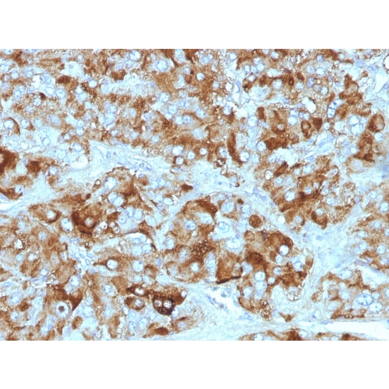 Immunohistochemistry - Anti-Chromogranin A Antibody [CGA/413 + CHGA/777 + CHGA/798] - BSA and Azide free (A251372) - Antibodies.com
