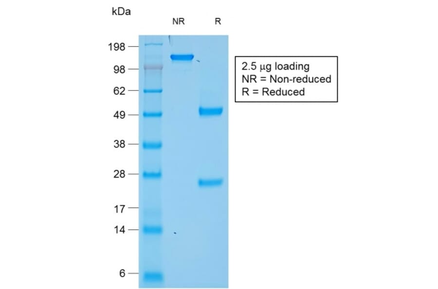 SDS-PAGE - Anti-Chromogranin A Antibody [rCHGA/777] - BSA and Azide free (A248191) - Antibodies.com