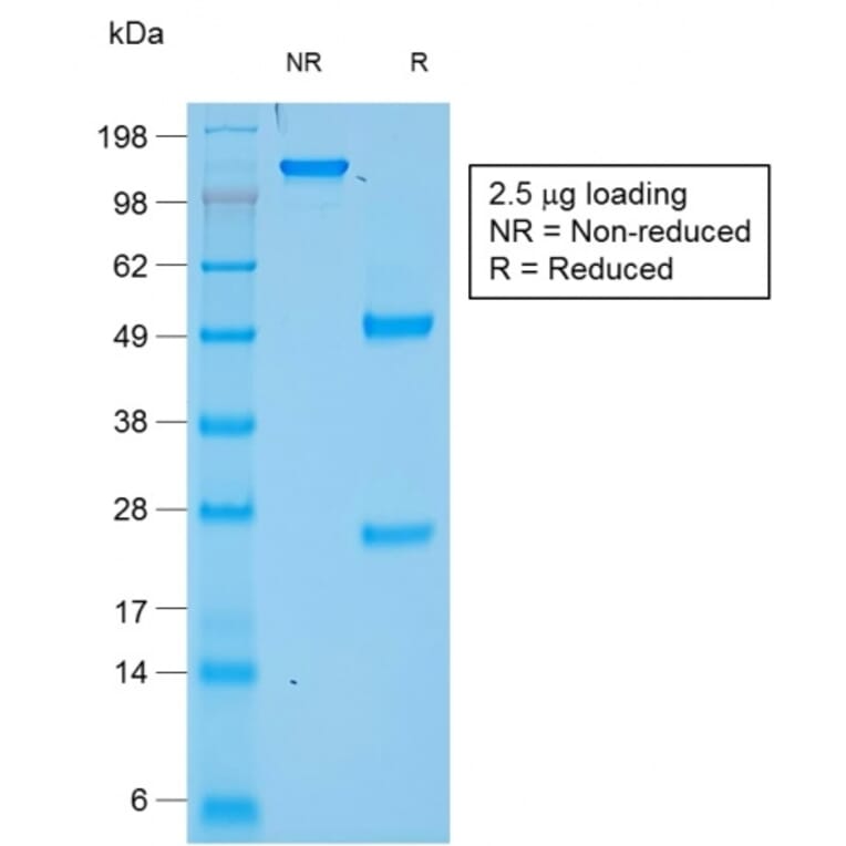SDS-PAGE - Anti-Chromogranin A Antibody [rCHGA/777] - BSA and Azide free (A248191) - Antibodies.com