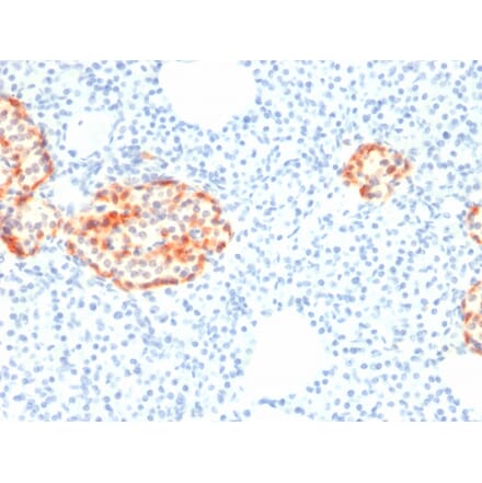 Immunohistochemistry - Anti-Chromogranin A Antibody [rCHGA/798] - BSA and Azide free (A251375) - Antibodies.com