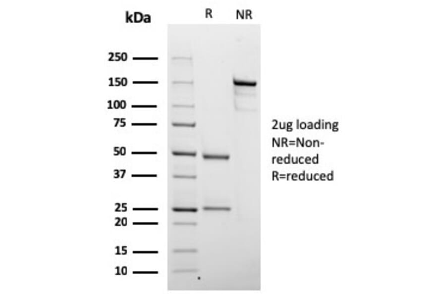 SDS-PAGE - Anti-Chromogranin A Antibody [rCHGA/798] - BSA and Azide free (A251375) - Antibodies.com