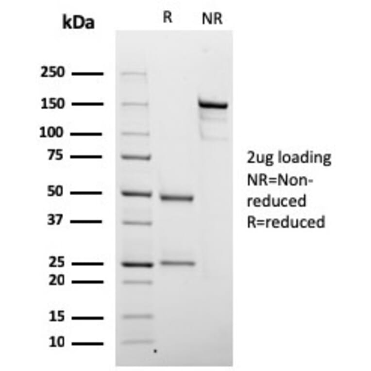 SDS-PAGE - Anti-Chromogranin A Antibody [rCHGA/798] - BSA and Azide free (A251375) - Antibodies.com