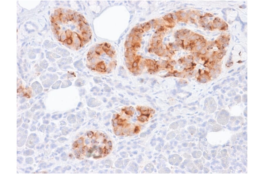 Immunohistochemistry - Anti-Chromogranin A Antibody [rCHGA/413] - BSA and Azide free (A251376) - Antibodies.com