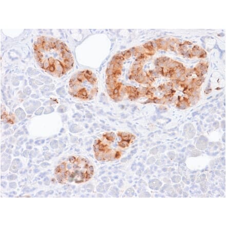 Immunohistochemistry - Anti-Chromogranin A Antibody [rCHGA/413] - BSA and Azide free (A251376) - Antibodies.com