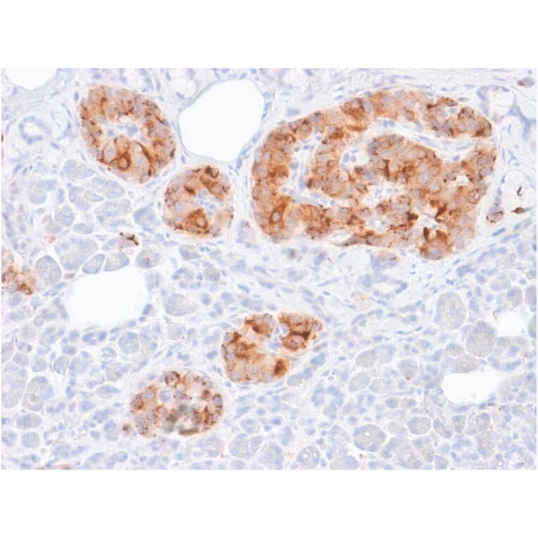 Immunohistochemistry - Anti-Chromogranin A Antibody [rCHGA/413] - BSA and Azide free (A251376) - Antibodies.com