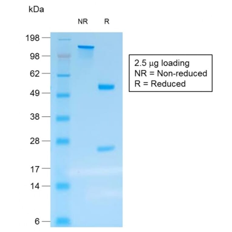 SDS-PAGE - Anti-Chromogranin A Antibody [rCHGA/413] - BSA and Azide free (A251376) - Antibodies.com