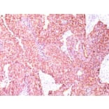 Immunohistochemistry - Anti-Chromogranin A Antibody [CGA/414] - BSA and Azide free (A251377) - Antibodies.com