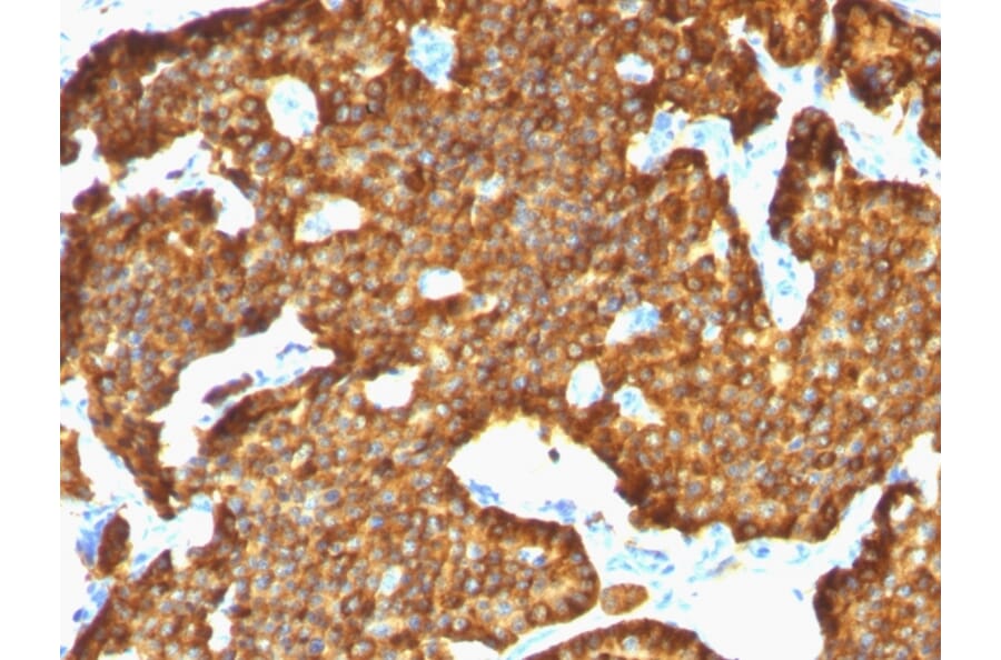 Immunohistochemistry - Anti-Chromogranin A Antibody [SPM553] - BSA and Azide free (A251377) - Antibodies.com