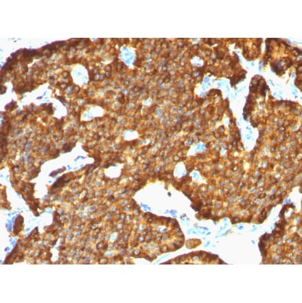 Immunohistochemistry - Anti-Chromogranin A Antibody [SPM553] - BSA and Azide free (A251377) - Antibodies.com