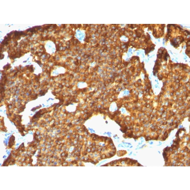 Immunohistochemistry - Anti-Chromogranin A Antibody [SPM553] - BSA and Azide free (A251377) - Antibodies.com
