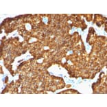 Immunohistochemistry - Anti-Chromogranin A Antibody [SPM553] - BSA and Azide free (A251377) - Antibodies.com