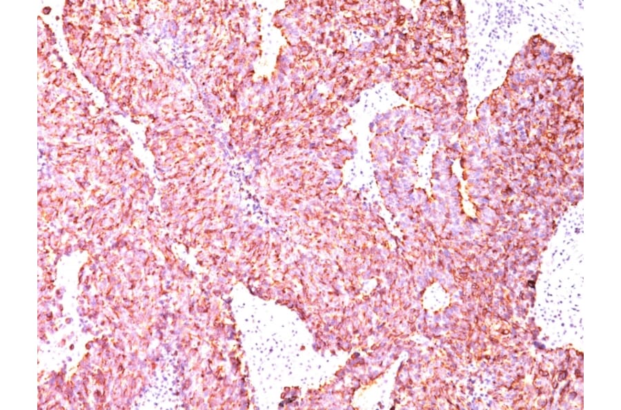 Immunohistochemistry - Anti-Chromogranin A Antibody [SPM585] - BSA and Azide free (A251381) - Antibodies.com
