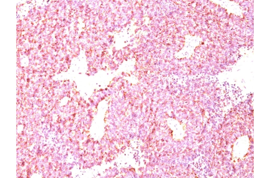 Immunohistochemistry - Anti-Chromogranin A Antibody [LK2H10 + PHE5] - BSA and Azide free (A251383) - Antibodies.com