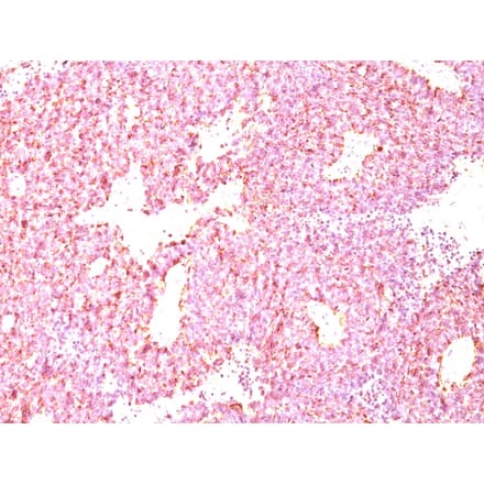 Immunohistochemistry - Anti-Chromogranin A Antibody [LK2H10 + PHE5] - BSA and Azide free (A251383) - Antibodies.com