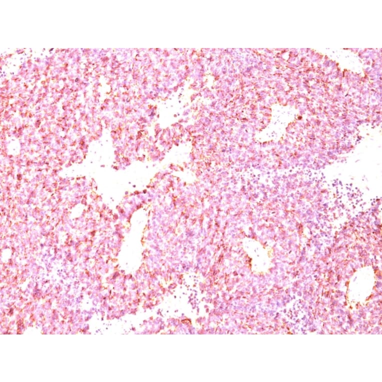 Immunohistochemistry - Anti-Chromogranin A Antibody [LK2H10 + PHE5] - BSA and Azide free (A251383) - Antibodies.com