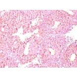 Immunohistochemistry - Anti-Chromogranin A Antibody [LK2H10 + PHE5] - BSA and Azide free (A251383) - Antibodies.com