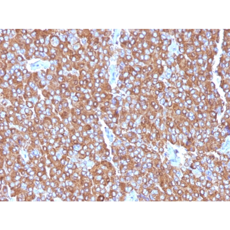 Immunohistochemistry - Anti-Chromogranin A Antibody [LK2H10 + PHE5 + CGA/414] - BSA and Azide free (A251383) - Antibodies.com