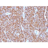 Immunohistochemistry - Anti-Chromogranin A Antibody [LK2H10 + PHE5 + CGA/414] - BSA and Azide free (A251383) - Antibodies.com