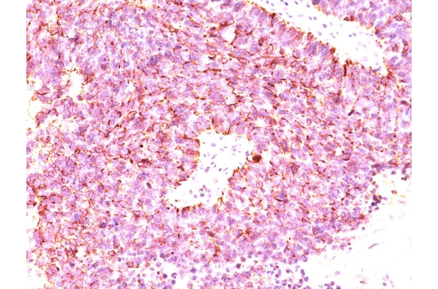 Immunohistochemistry - Anti-Chromogranin A Antibody [LK2H10 + PHE5 + CGA/414] - BSA and Azide free (A251384) - Antibodies.com