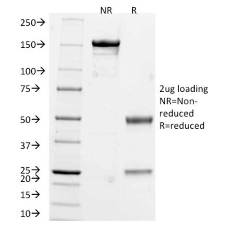SDS-PAGE - Anti-Chromogranin A Antibody [CHGA/765] - BSA and Azide free (A251385) - Antibodies.com