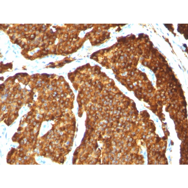 Immunohistochemistry - Anti-Chromogranin A Antibody [CHGA/777] - BSA and Azide free (A251386) - Antibodies.com