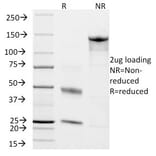 SDS-PAGE - Anti-Chromogranin A Antibody [CHGA/798] - BSA and Azide free (A251387) - Antibodies.com