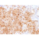 Immunohistochemistry - Anti-Chromogranin A Antibody [CHGA/1731R] - BSA and Azide free (A251389) - Antibodies.com