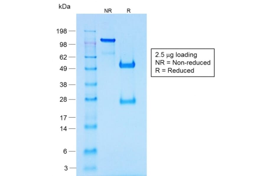 SDS-PAGE - Anti-Chromogranin A Antibody [CHGA/1731R] - BSA and Azide free (A251389) - Antibodies.com