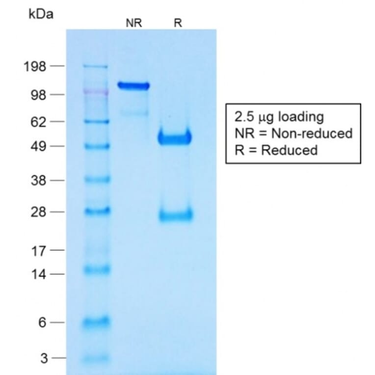 SDS-PAGE - Anti-Chromogranin A Antibody [CHGA/1731R] - BSA and Azide free (A251389) - Antibodies.com