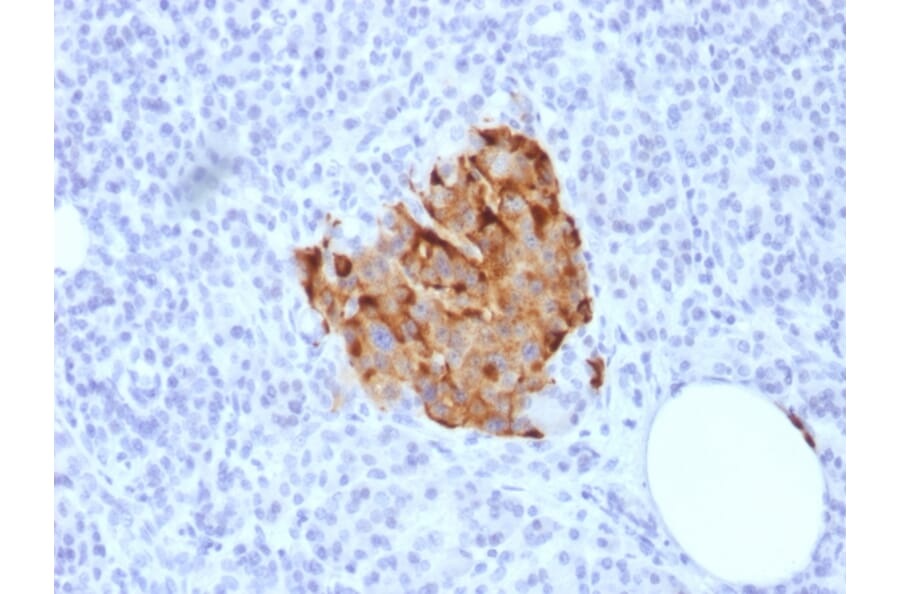 Immunohistochemistry - Anti-Chromogranin A Antibody [CHGA/1773R] - BSA and Azide free (A251389) - Antibodies.com