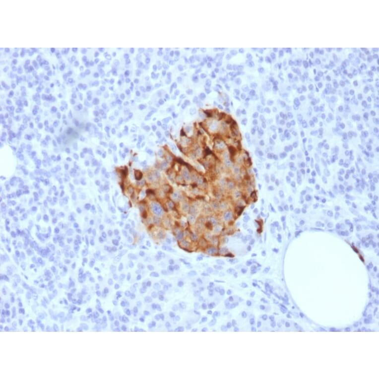 Immunohistochemistry - Anti-Chromogranin A Antibody [CHGA/1773R] - BSA and Azide free (A251389) - Antibodies.com
