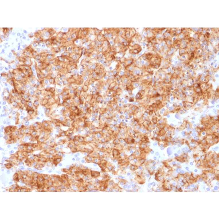 Immunohistochemistry - Anti-Chromogranin A Antibody [CHGA/1773R] - BSA and Azide free (A251390) - Antibodies.com