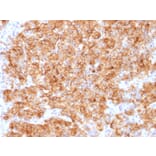 Immunohistochemistry - Anti-Chromogranin A Antibody [CHGA/1773R] - BSA and Azide free (A251390) - Antibodies.com