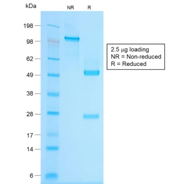 SDS-PAGE - Anti-Chromogranin A Antibody [CHGA/1815R] - BSA and Azide free (A251391) - Antibodies.com